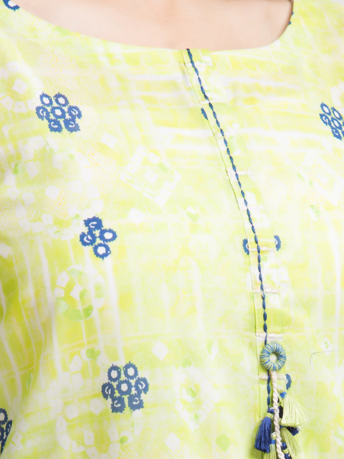 Printed Lawn Shirt - EWU23A1-28000S - Image 2